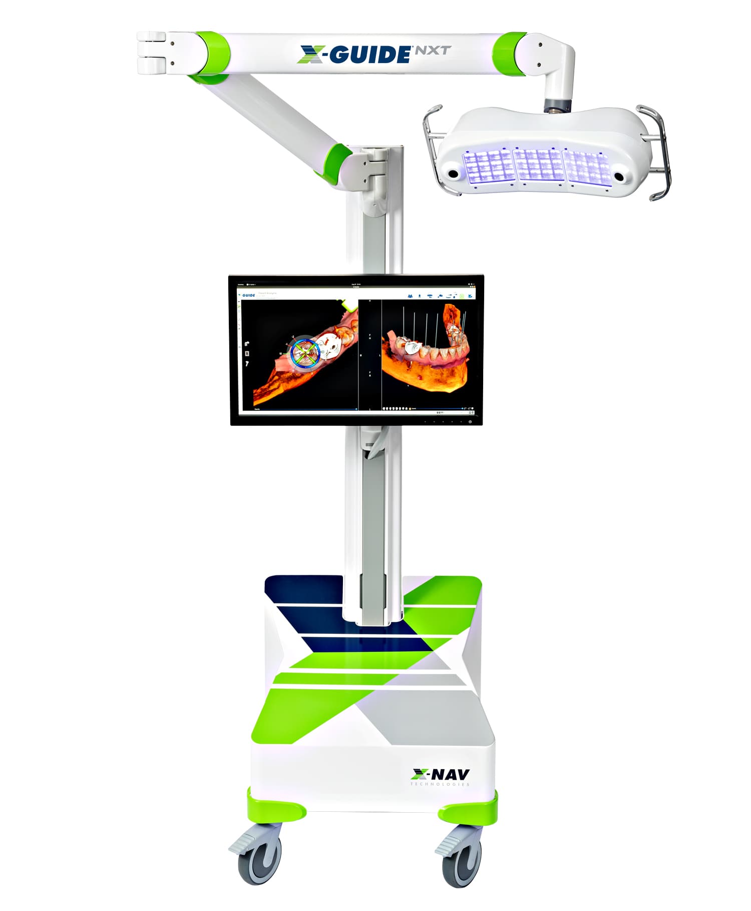 Navigační systém X-Guide NXT, mobilní stojan s polohovatelným ramenem, LED světlem a monitorem zobrazujícím 3D snímek čelisti s plánovanou pozicí implantátu